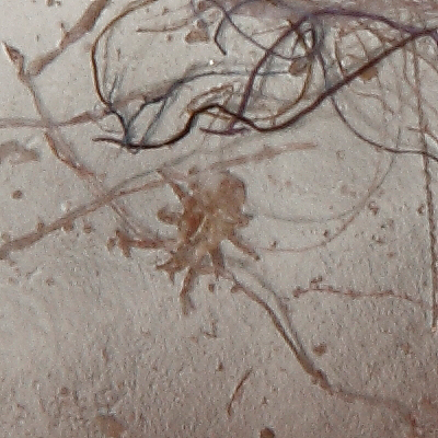 ID microacari